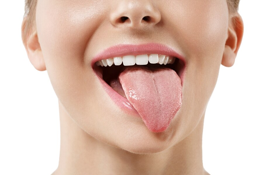 Kenali Tanda Asam Lambung Lewat Lidah Putih!